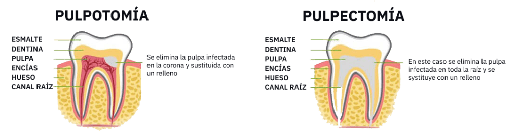 Endodoncia – Clínica Dental Conil